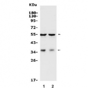 Western blot testing of human 1) HepG2 and 2) A549 cell lysate with BAG-1 antibody. Predicted molecular weight ~50 kDa (long form), 29-33 (short form).