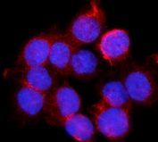 Immunofluorescent staining of FFPE human A431 cells with BDH1 antibody (red) and DAPI nuclear stain (blue). HIER: steam section in pH6 citrate buffer for 20 min.