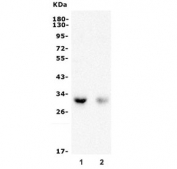 Western blot testing of 1) rat liver and 2) human COLO-320 lysate with BDH1 antibody. Predicted molecular weight ~38 kDa.