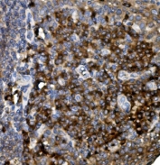IHC staining of FFPE human tonsil with CD74 antibody. HIER: boil tissue sections in pH8 EDTA for 20 min and allow to cool before testing.