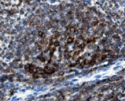 IHC staining of FFPE mouse spleen with CD74 antibody. HIER: boil tissue sections in pH8 EDTA for 20 min and allow to cool before testing.