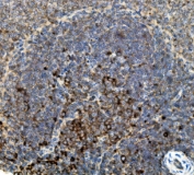 IHC staining of FFPE rat spleen with CD74 antibody. HIER: boil tissue sections in pH8 EDTA for 20 min and allow to cool before testing.