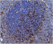 IHC staining of FFPE rat spleen with Cd82 antibody. HIER: boil tissue sections in pH8 EDTA for 20 min and allow to cool before testing.