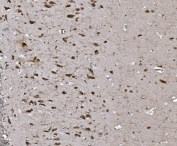 IHC staining of FFPE rat brain with NAF-1 antibody. HIER: boil tissue sections in pH8 EDTA for 20 min and allow to cool before testing.