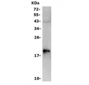 Western blot testing of human Caco-2 cell lysate with CLDN3 antibody. Predicted molecular weight ~23 kDa.
