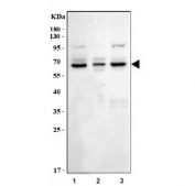 Western blot testing of human 1) HCCT, 2) HepG2 and 3) HL-60 cell lysate with CYP7A1 antibody. Predicted molecular weight ~54 kDa.