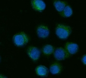 Immunofluorescent staining of FFPE human SiHa cells with CYP7A1 antibody (green) and DAPI nuclear stain (blue). HIER: steam section in pH6 citrate buffer for 20 min.