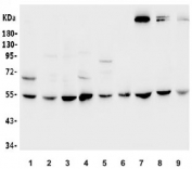 Western blot testing of human 1) placenta, 2) HeLa, 3) HepG2, 4) A431, 5) Raji, 6) ThP-1, 7) rat PC-12, 8) mouse NIH 3T3 and 9) mouse HEPA1-6 lysate with DDX6 antibody. Predicted molecular weight ~53 kDa.