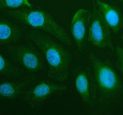 Immunofluorescent staining of FFPE human U-2 OS cells with DDX6 antibody (green) and DAPI nuclear stain (blue). HIER: steam section in pH6 citrate buffer for 20 min.
