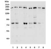 Western blot testing of human 1) HeLa, 2) HEK293, 3) Jurkat, 4) HepG2, 5) SW620, 6) K562, 7) mouse Neuro-2a and 8) mouse ANA-1 lysate with Ribonuclease 3 antibody. Predicted molecular weight ~159 kDa.