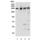 Western blot testing of human 1) A431, 2) A549, 3) U-87 MG and 4) HeLa lysate with EGF Receptor antibody. Expected molecular weight: 134-180 kDa depending on glycosylation level.