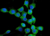 Immunofluorescent staining of FFPE human A431 cells with EGF Receptor antibody (green) and DAPI nuclear stain (blue). HIER: steam section in pH6 citrate buffer for 20 min.