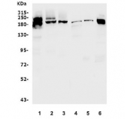 Western blot testing of 1) human U-87 MG, 2) human HepG2, 3) monkey COS-7, 4) mouse brain, 5) mouse lung and 6) mouse ANA-1 lysate with EIF2AK4 antibody. Predicted molecular weight ~186 kDa.