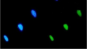 Immunofluorescent staining of FFPE human HeLa cells with EIF2B1 antibody (green) and DAPI nuclear stain (blue). HIER: steam section in pH6 citrate buffer for 20 min.