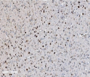 IHC staining of FFPE rat brain with EIF2B1 antibody. HIER: boil tissue sections in pH8 EDTA for 20 min and allow to cool before testing.