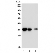 Western blot testing of 1) rat liver, 2) rat kidney and 3) mouse liver lysate with EIF2B1 antibody. Predicted molecular weight ~34 kDa.
