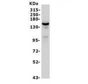 Western blot testing of human HeLa cells with VEGFR1 antibody. Predicted molecular weight ~150 kDa but may be observed at higher molecular weights due to glycosylation.