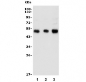 Western blot testing of human 1) HeLa, 2) MCF7 and 3) HEK293 lysate with Galactosidase alpha antibody. Predicted molecular weight ~48 kDa.
