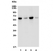 Western blot testing of human 1) HepG2, 2) K562, 3) SW620 and 4) A431 lysate with GRB7 antibody. Predicted molecular weight: 60 kDa.