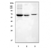 Western blot testing of human 1) HepG2, 2) K562, 3) SW620 and 4) A431 lysate with GRB7 antibody. Predicted molecular weight: 60 kDa.