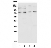 Western blot testing of human 1) human HeLa, 2) human HepG2, 3) human 293T, 4) monkey COS-7, 5) human K562, 6) human U-87 MG, 7) human HEL, 8) rat liver, 9) rat brain, 10) mouse liver and 11) mouse brain tissue lysate with GRB10 antibody. Expected molecular weight: 58-70 kDa.