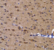 IHC staining of FFPE mouse brain tissue with GRB10 antibody. HIER: boil tissue sections in pH8 EDTA for 20 min and allow to cool before testing.