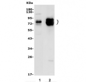 Western blot testing of 1) mouse brain and 2) rat NRK lysate with GRB10 antibody. Expected molecular weight: 58-70 kDa.