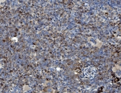 IHC staining of FFPE mouse spleen with GRB10 antibody. HIER: boil tissue sections in pH8 EDTA for 20 min and allow to cool before testing.