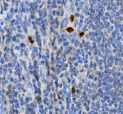 IHC staining of FFPE human tonsil with JUNB antibody. HIER: boil tissue sections in pH8 EDTA for 20 min and allow to cool before testing.