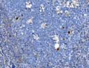 IHC staining of FFPE human tonsil with JUNB antibody. HIER: boil tissue sections in pH8 EDTA for 20 min and allow to cool before testing.