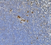 IHC staining of FFPE human tonsil with JUNB antibody. HIER: boil tissue sections in pH8 EDTA for 20 min and allow to cool before testing.