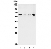 Western blot testing of 1) human SH-SY5Y, 2) rat C6, 3) mouse Neuro-2a and 4) human HEK293 lysate with LGI1 antibody. Predicted molecular weight ~64 kDa.