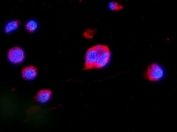 Immunofluorescent staining of FFPE human K562 cells with MAP2K2 antibody (red) and DAPI nuclear stain (blue). HIER: steam section in pH6 citrate buffer for 20 min.