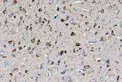 IHC staining of FFPE mouse brain with MAP2K2 antibody. HIER: boil tissue sections in pH8 EDTA for 20 min and allow to cool before testing.