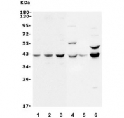 Western blot testing of human 1) HEK293, 2) Jurkat, 3) K562, 4) rat brain, 5) rat lung, 6) mouse ANA-1 lysate with MAP2K2 antibody. Predicted molecular weight ~45 kDa.