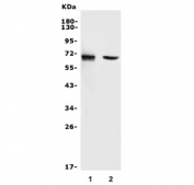Western blot testing of 1) human U-87 MG and 2) rat lung lysate with MMP2 antibody. Expected molecular weight: ~72 kDa (pro form), ~63 kDa (cleaved form).