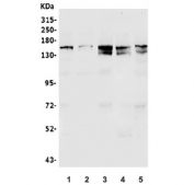 Western blot testing of human 1) HEK293, 2) HepG2, 3) SK-O-V3, 4) U-87 MG and 5) K562 lysate with MSH6 antibody. Expected molecular weight: 120-160 kDa depending on phosphorylation level.