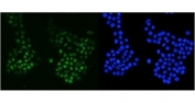 Western blot testing of human 1) HEK293, 2) HepG2, 3) SK-O-V3, 4) U-87 MG and 5) K562 lysate with MSH6 antibody. Expected molecular weight: 120-160 kDa depending on phosphorylation level.