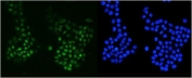 Immunofluorescent staining of FFPE human A431 cells with MSH6 antibody (green) and DAPI nuclear stain (blue). HIER: steam section in pH6 citrate buffer for 20 min.