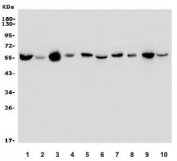 Western blot testing of 1) human HeLa, 2) human HEK293, 3) monkey heart, 4) human placenta, 5) rat heart, 6) rat brain, 7) rat kidney, 8) mouse heart, 9) mouse kidney and 10) mouse ANA-1 lysate with OXCT1 antibody. Predicted molecular weight ~56 kDa. 