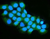 Immunofluorescent staining of FFPE human A431 cells with OXCT1 antibody (green) and DAPI nuclear stain (blue). HIER: steam section in pH6 citrate buffer for 20 min.