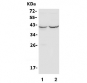 Western blot testing of human 1) HeLa and 2) HEK293 lysate with PDX1 antibody. Observed molecular weight 31/40-46kDa (unmodified/modified).