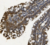 IHC staining of FFPE mouse intestine with PHB2 antibody. HIER: boil tissue sections in pH8 EDTA for 20 min and allow to cool before testing.