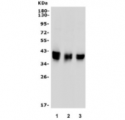 Western blot testing of 1) rat liver, 2) mouse liver and 3) monkey liver lysate with Paraoxonase 1 antibody. Predicted molecular weight: ~40 kDa.