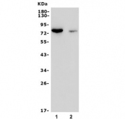Western blot testing of human 1) K562 and 2) blood lysate with PKC theta antibody. Predicted molecular weight ~78 kDa.