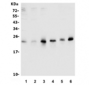 Western blot testing of human 1) K562, 2) HepG2, 3) HEK293, 4) HeLa, 5) rat PC-12 and 6) mouse NIH 3T3 lysate with RAB9A antibody. Expected molecular weight: ~23 kDa.