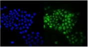 Immunofluorescent staining of FFPE human A431 cells with RAB9A antibody (green) and DAPI nuclear stain (blue). HIER: steam section in pH6 citrate buffer for 20 min.