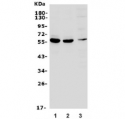 Western blot testing of 1) rat brain, 2) mouse brain and 3) NIH 3T3 lysate with Rnf8 antibody. Predicted molecular weight ~56 kDa but may be observed at larger sizes due to ubiquitination.
