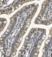 IHC staining of FFPE rat intestine with SAMHD1 antibody. HIER: boil tissue sections in pH8 EDTA for 20 min and allow to cool before testing.