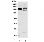 Western blot testing of 1) rat brain and 2) mouse brain lysate with SHANK3 antibody. Expected molecular weight ~185 kDa.